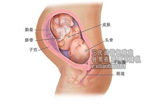 输卵管伞端积水，可以做香港助孕试管婴儿吗?
